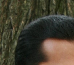 hair_growth_profile